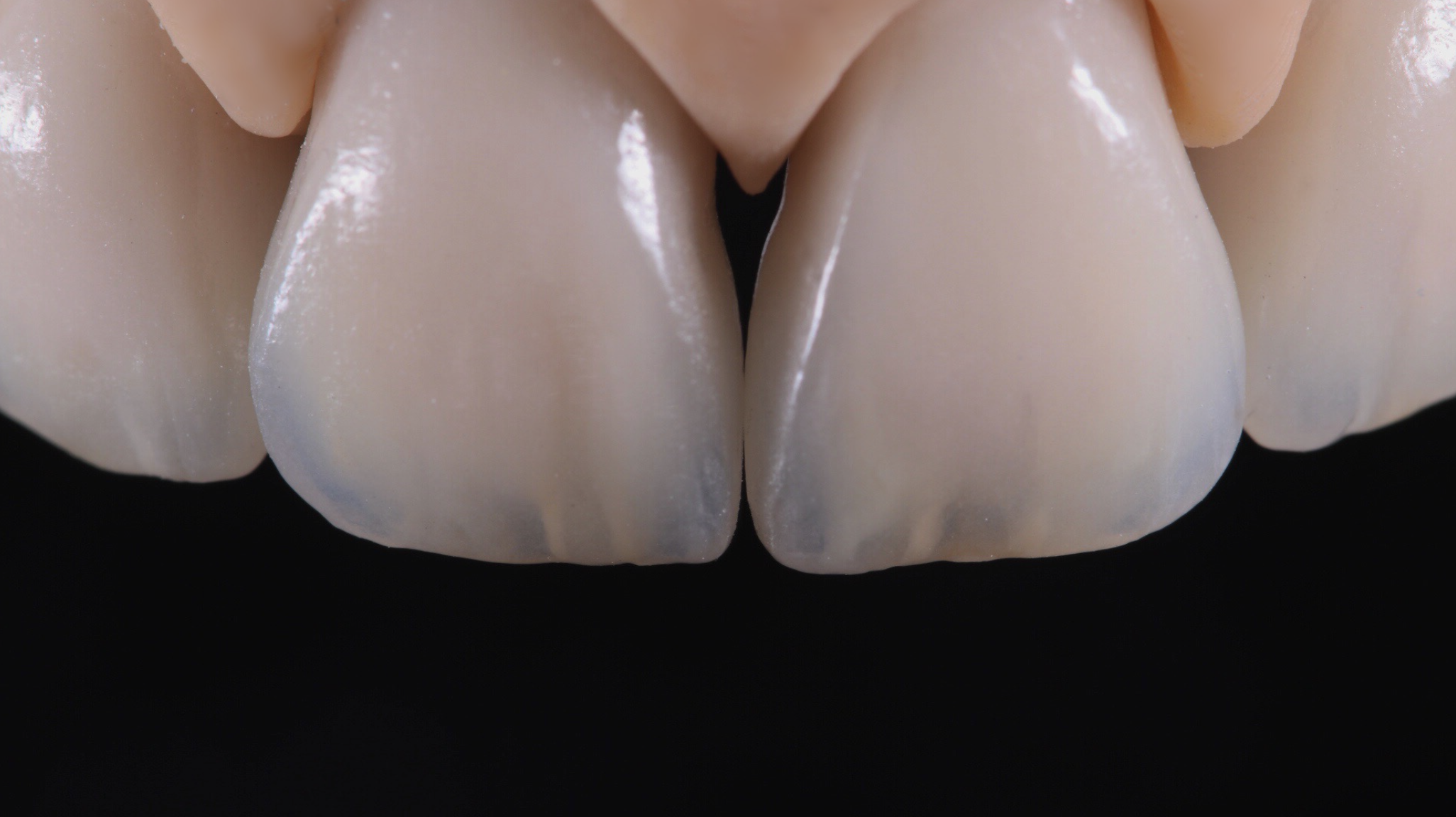ZrPro® Ceram Master Class: With Serhii Yurchenko - Elegant Dent